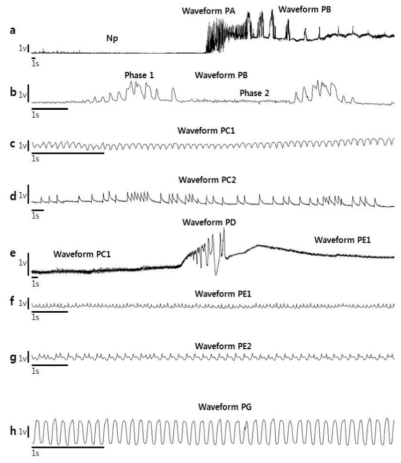 http://dam.zipot.com:8080/sites/kjoas/files/N0030430205_image/Figure_KJAOS_43_02_05_F4.jpg